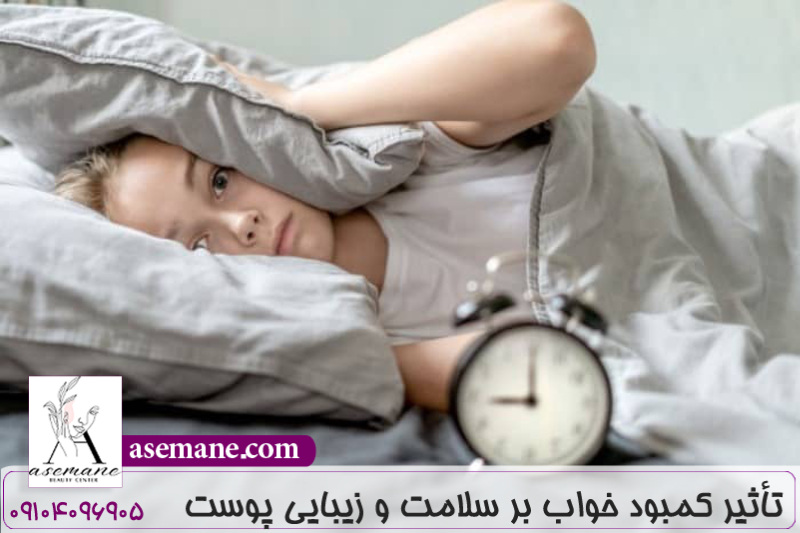 تأثیر کمبود خواب بر سلامت و زیبایی پوست