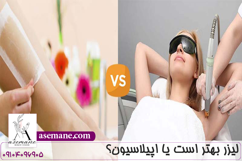 لیزر بهتر است یا اپیلاسیون؟ 