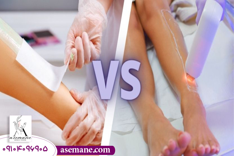 مقایسه دفعات مورد نیاز انجام اپیلاسیون با لیزر 