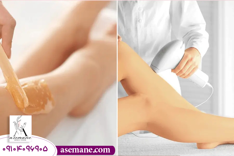 مقایسه عوارض جانبی اپیلاسیون و لیزر 