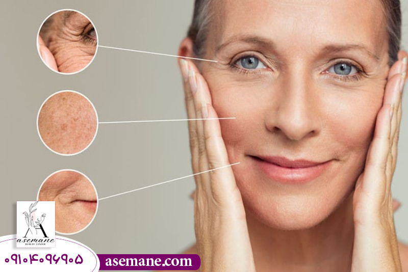 کاربردهای فیلر در زیبایی و جوانسازی 