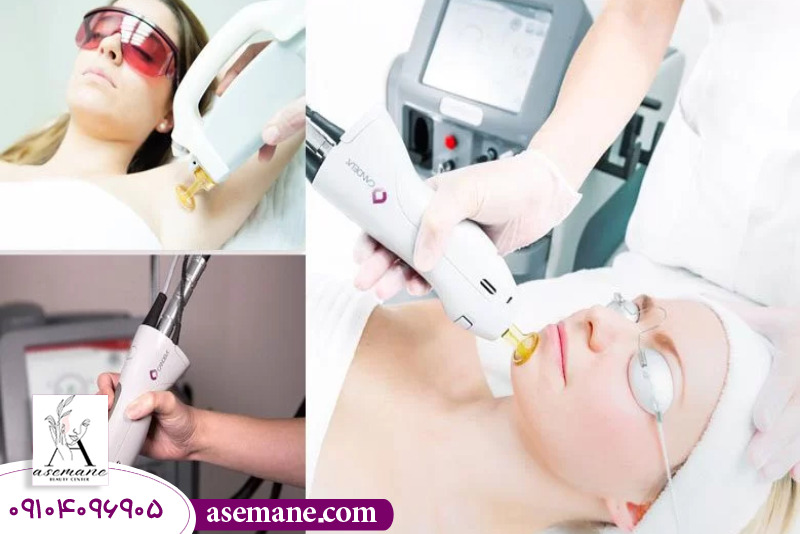 بررسی بهترین برندهای دستگاه لیزر موهای زائد