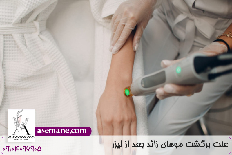 علت برگشت موهای زائد بعد از لیزر 