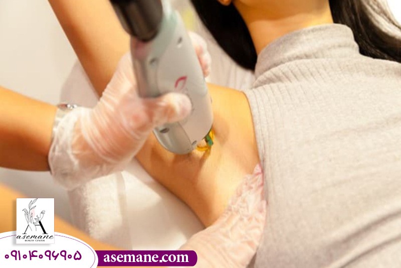 مراقبت های ضروری قبل و بعد از لیزر برای جلوگیری از برگشت مو