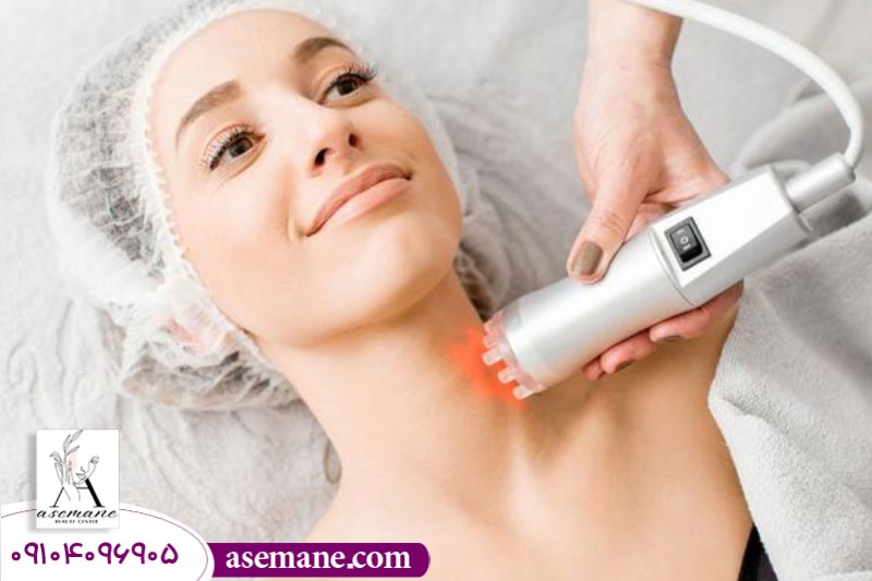 آر اف فرکشنال برای جمع شدن پوست غبغب