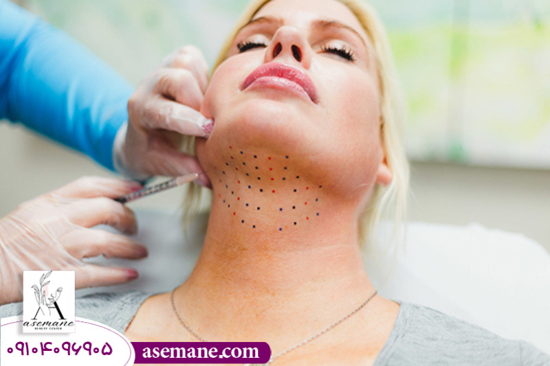 تزریق مواد چربی سوز در ناحیه غبغب